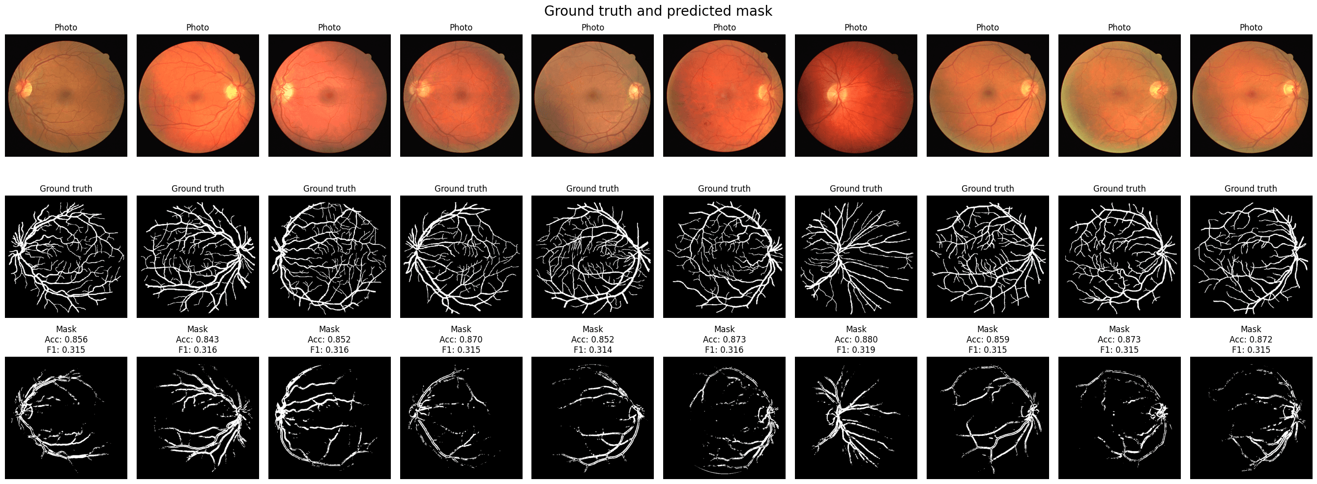 Blood Vessel Segmentation