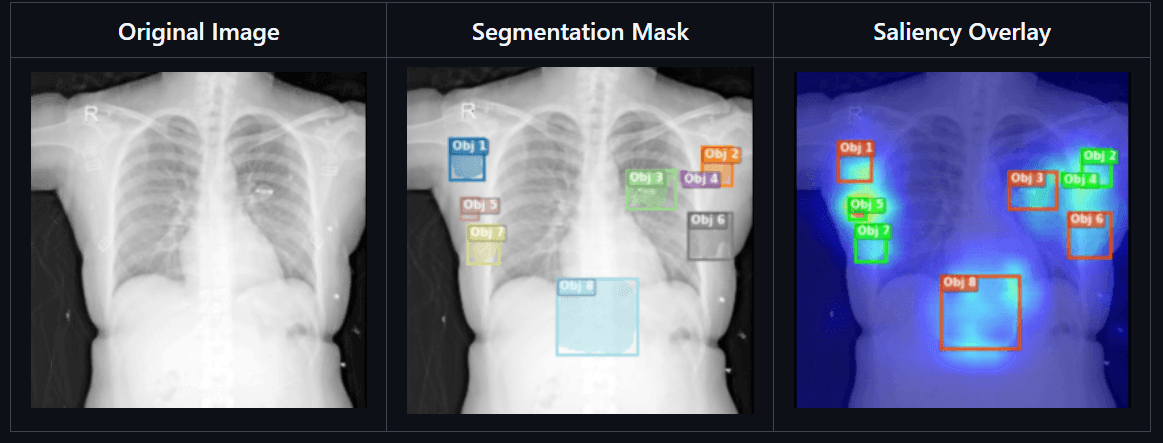 Explainable Artificial Intelligence for Image Quality Assessment Master's Thesis Project